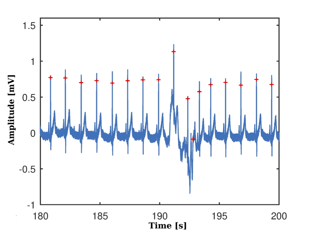 R peaks detection from ECG signal